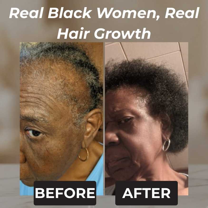 Rennora Hair Growth Serum
