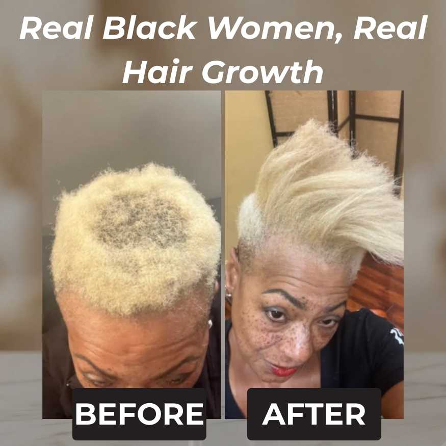 Rennora Hair Growth Serum