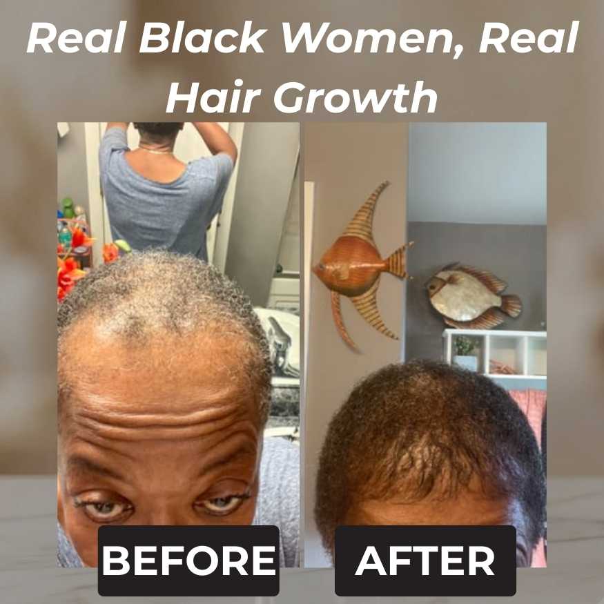 Rennora Hair Growth Serum