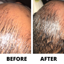 Load image into Gallery viewer, Three Bottles of Rennora EXTRA-Strength Hair Growth Serum