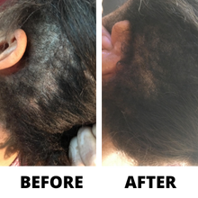 Load image into Gallery viewer, Three Bottles of Rennora EXTRA-Strength Hair Growth Serum
