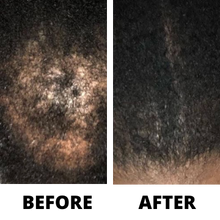 Load image into Gallery viewer, Three Bottles of Rennora EXTRA-Strength Hair Growth Serum