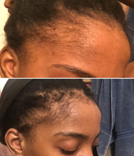 Load image into Gallery viewer, Three Bottles of Rennora EXTRA-Strength Hair Growth Serum
